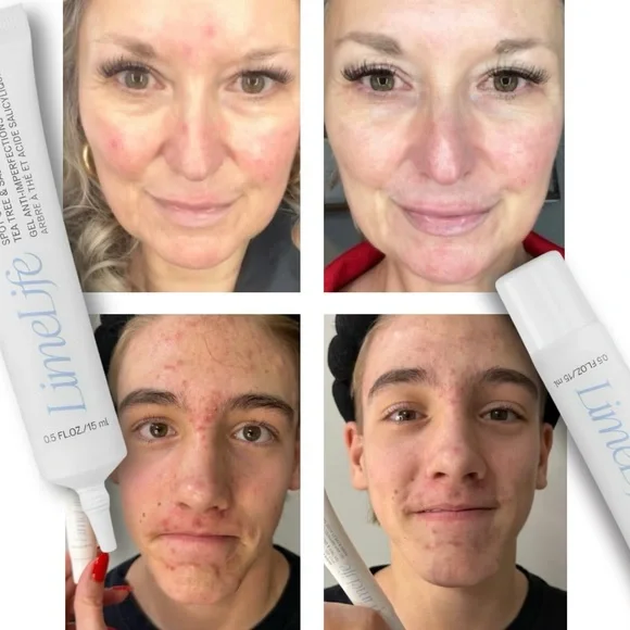 Quick fix - Picture 7 of 12